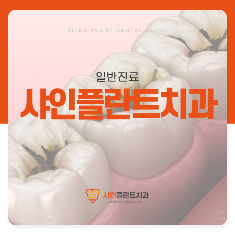 샤인플란트치과, 치아우식증 초기 관리가 중요합니다