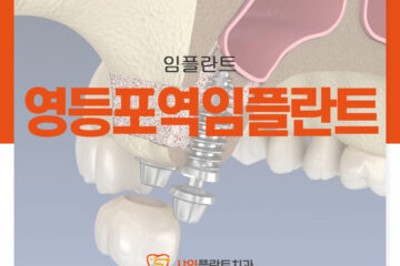 영등포역임플란트