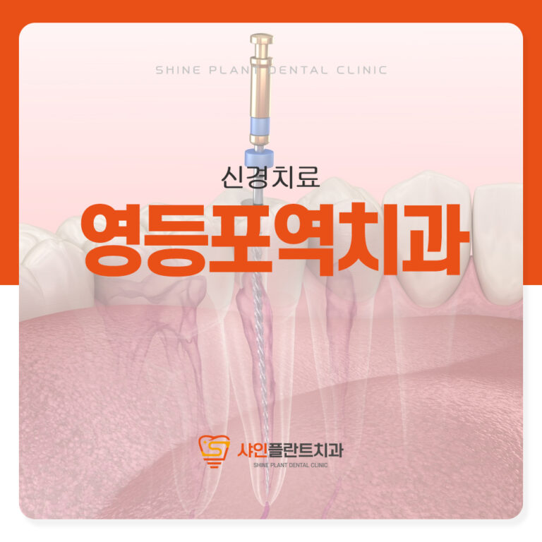 영등포역치과 치아 신경치료로 자연 치아를 살릴 수 있는 기회