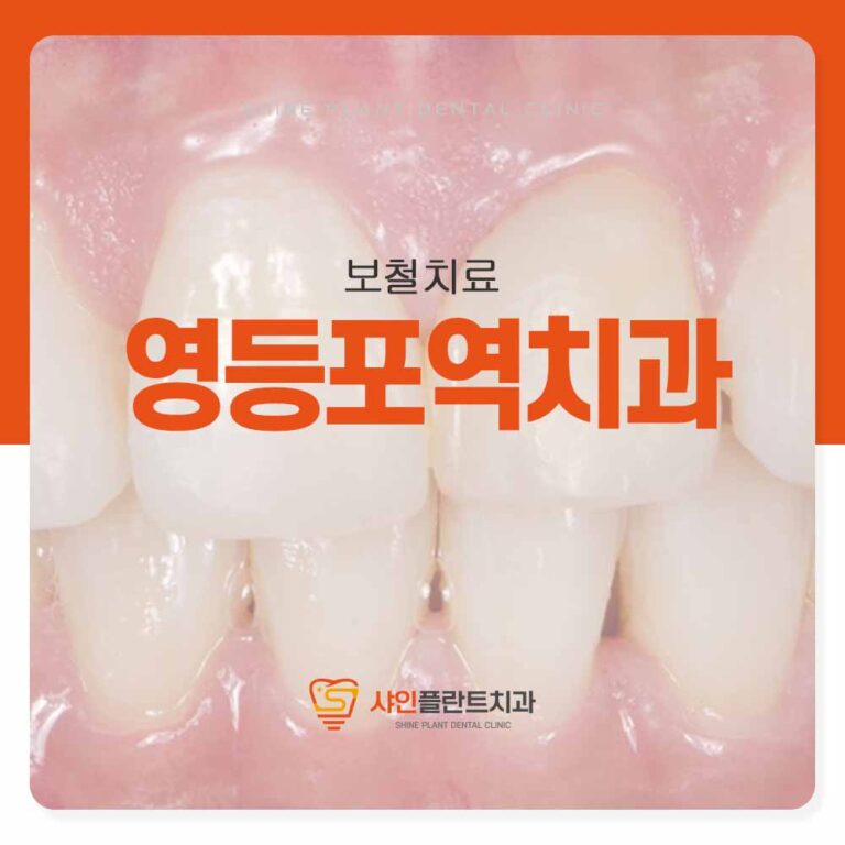 영등포역치과 블랙트라이앵글 레진으로 치료 가능할까요?