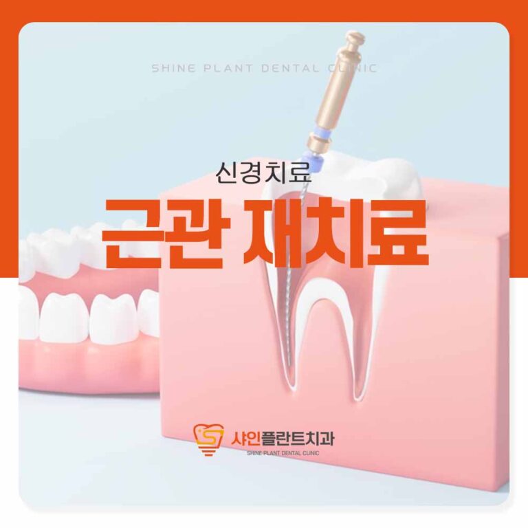 샤인플란트치과 근관 재치료 임플란트를 하기 전에