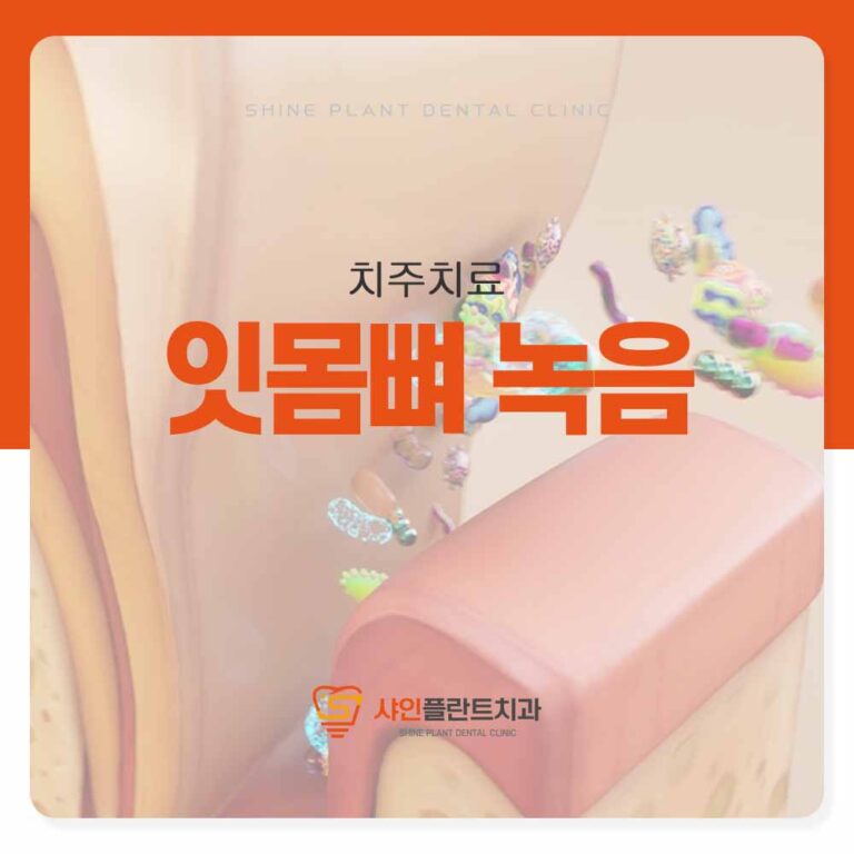 영등포역치과 잇몸뼈 녹음 치아 흔들리는 이유