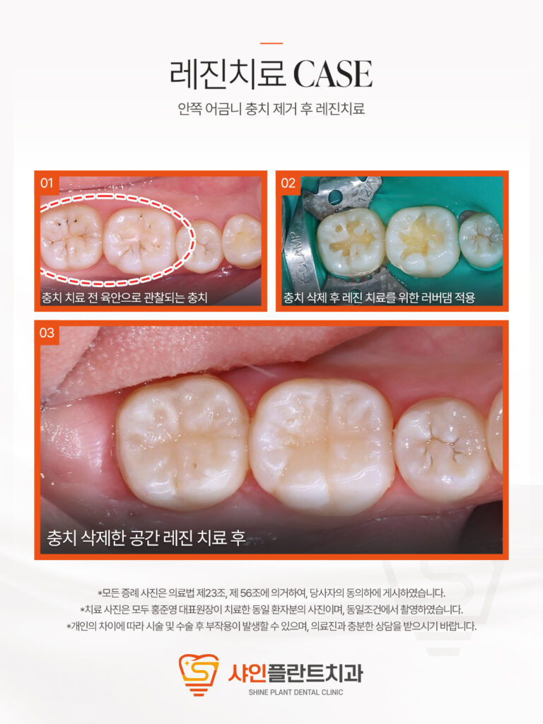 치료 사례 6