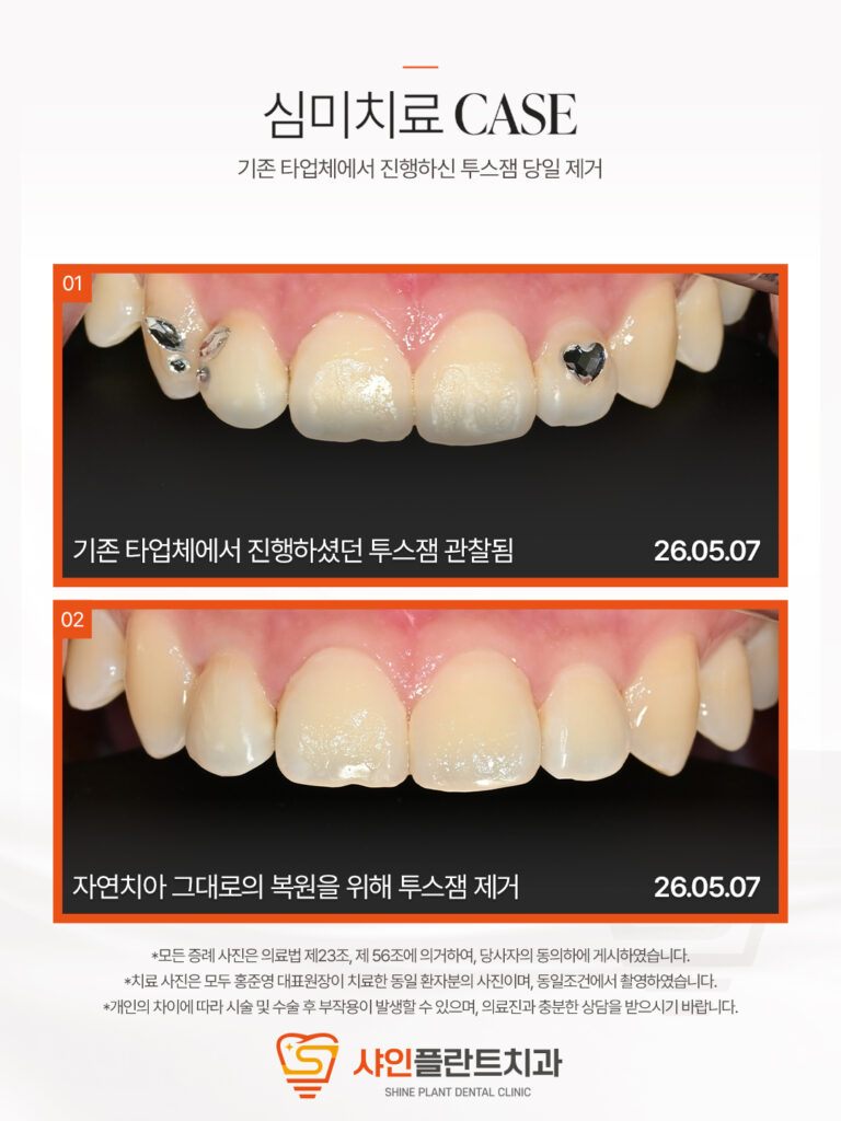 치료 사례 2
