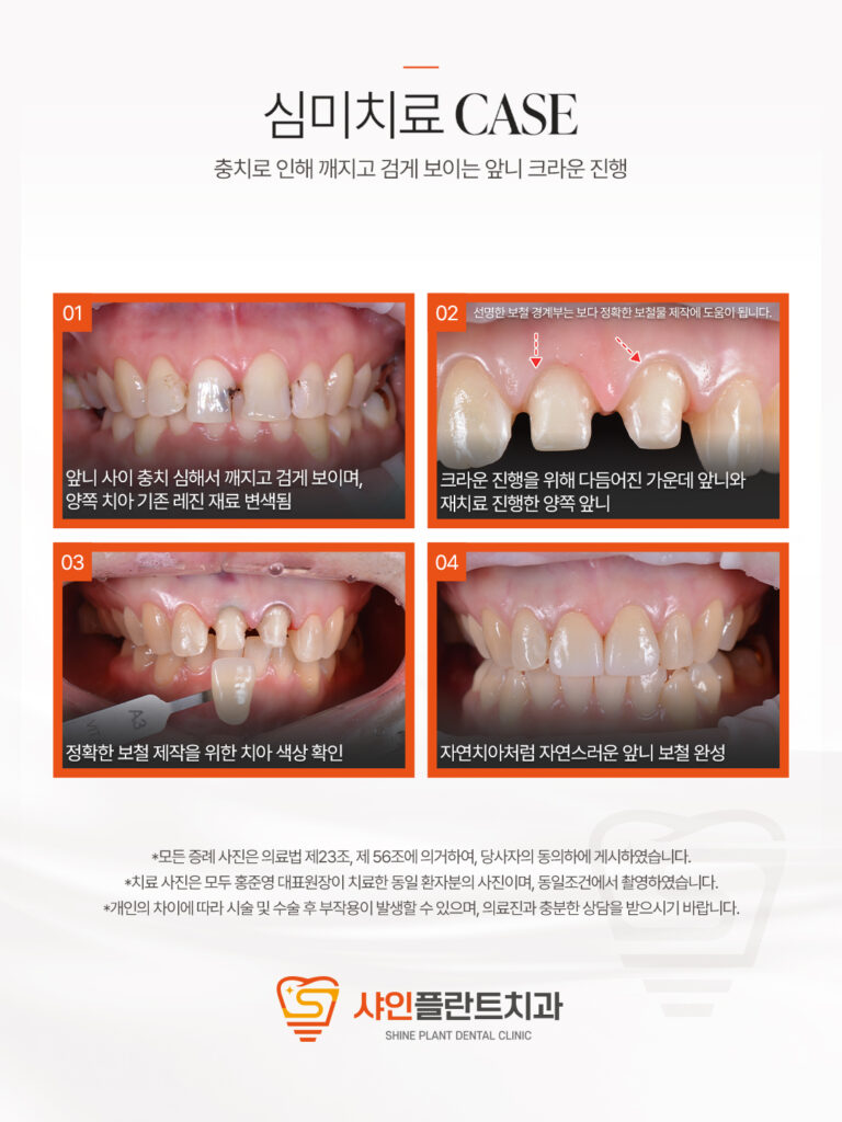 치료 사례 3