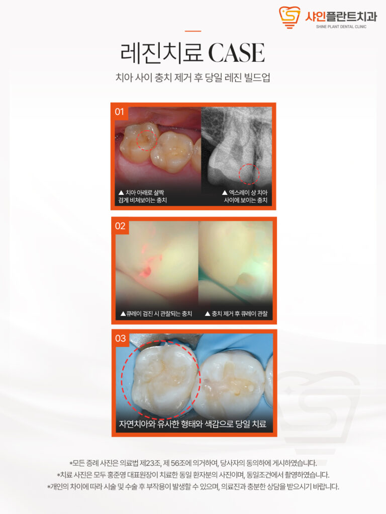 치료 사례 2