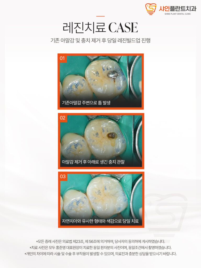 치료 사례 1